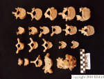 L_V20d5095 A16.175 R827 lR at vertebrae, superior view.JPG L_V20d5095 A16.175 R827 lR at vertebrae, superior view